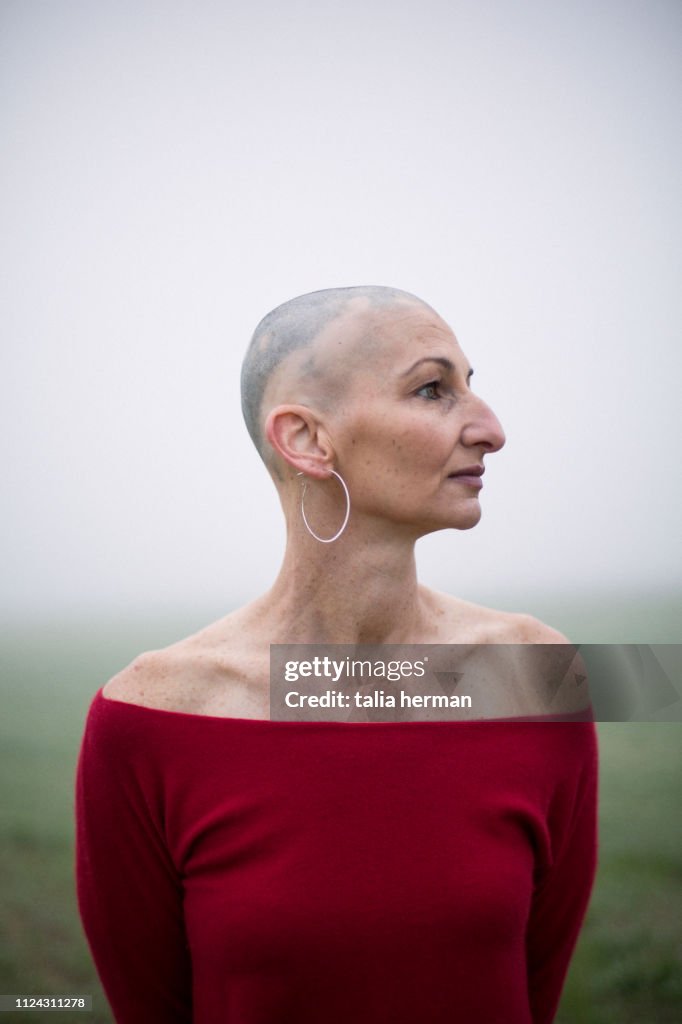 Portrait of woman with alopecia