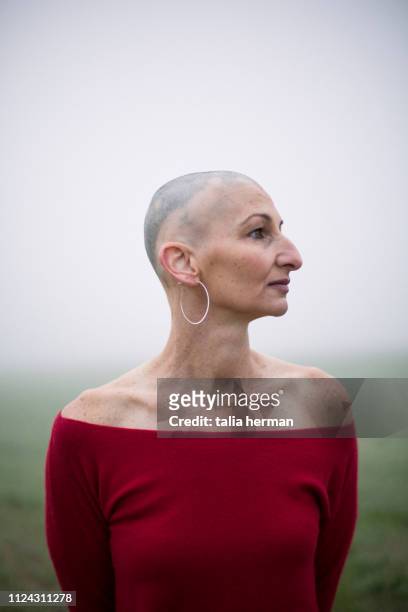 portrait of woman with alopecia - hair loss stock pictures, royalty-free photos & images
