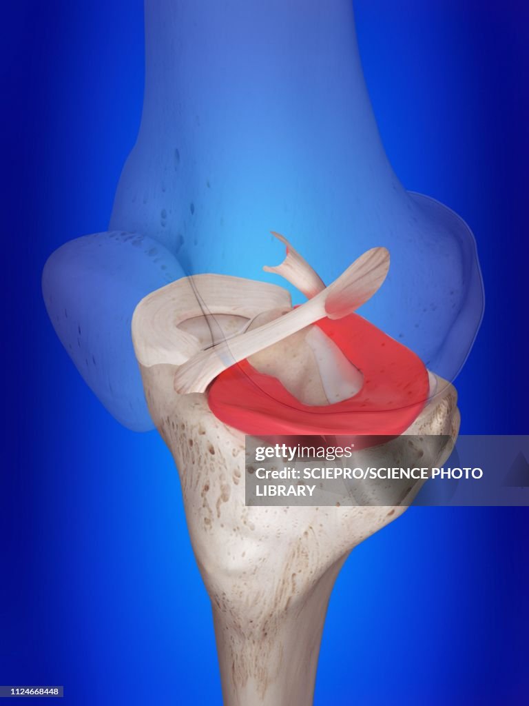Illustration of the lateral meniscus