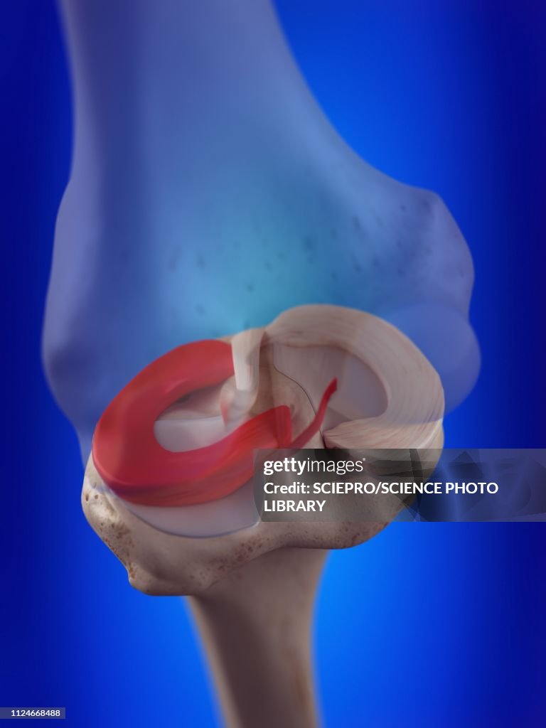 Illustration of the lateral meniscus