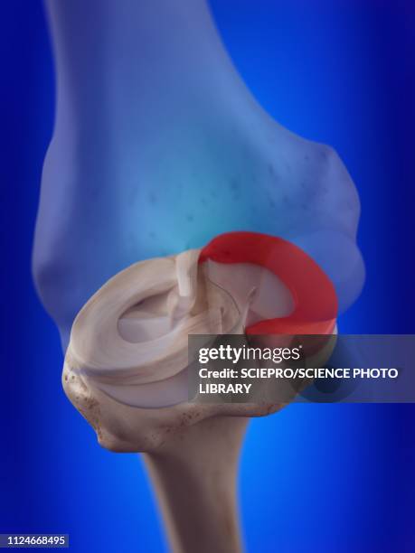 illustration of the medial meniscus - anterior cruciate ligament stock illustrations