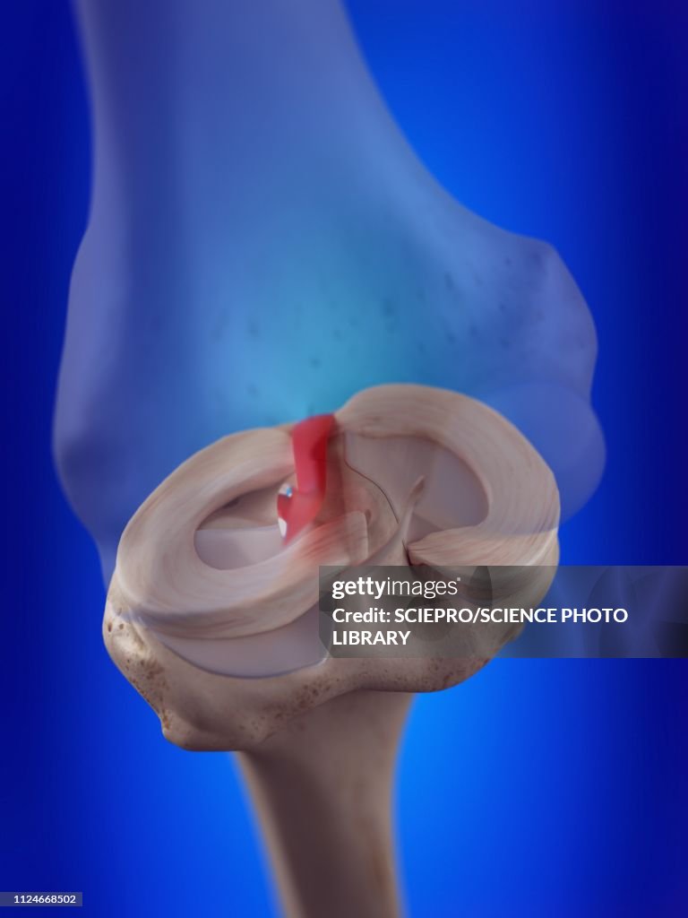 Illustration of the anterior cruciate ligament