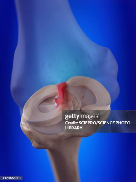 illustration of the anterior cruciate ligament - anterior cruciate ligament stock illustrations