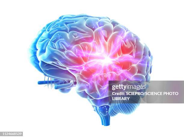 stockillustraties, clipart, cartoons en iconen met illustration of a painful brain - inflammation