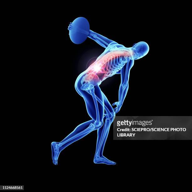 ilustraciones, imágenes clip art, dibujos animados e iconos de stock de illustration of an athlete's painful spine - discus