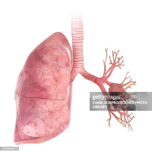 illustration of lung cancer - lung tumour stock illustrations