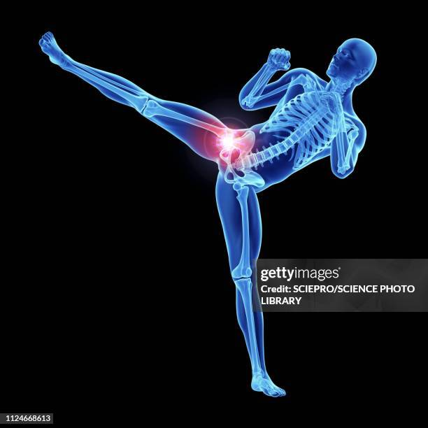 illustration of an athlete's painful hip joint - gout stock illustrations