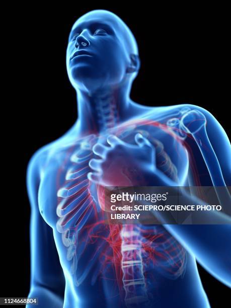 ilustrações, clipart, desenhos animados e ícones de illustration of a man with chest pain - artéria coronária