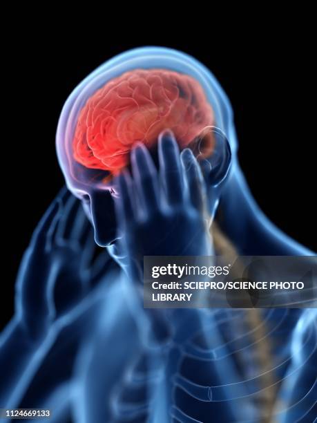 ilustraciones, imágenes clip art, dibujos animados e iconos de stock de illustration of a man with a headache - head injury