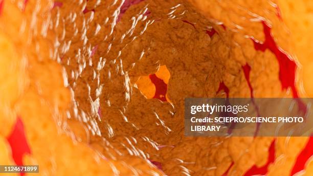 ilustraciones, imágenes clip art, dibujos animados e iconos de stock de illustration of fat inside of an artery - arteria
