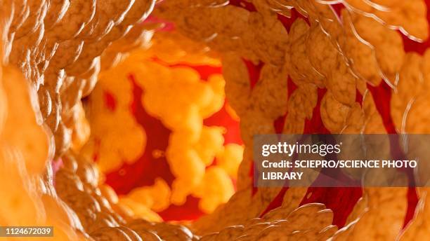 illustration of fat inside of an artery - plaque stock illustrations