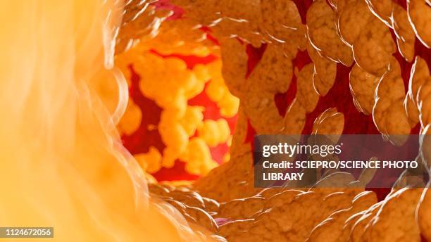 illustration of fat inside of an artery - clogged artery stock illustrations