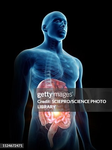 Illustration of a painful digestiverticale system Illustration of a painful digestiverticale system