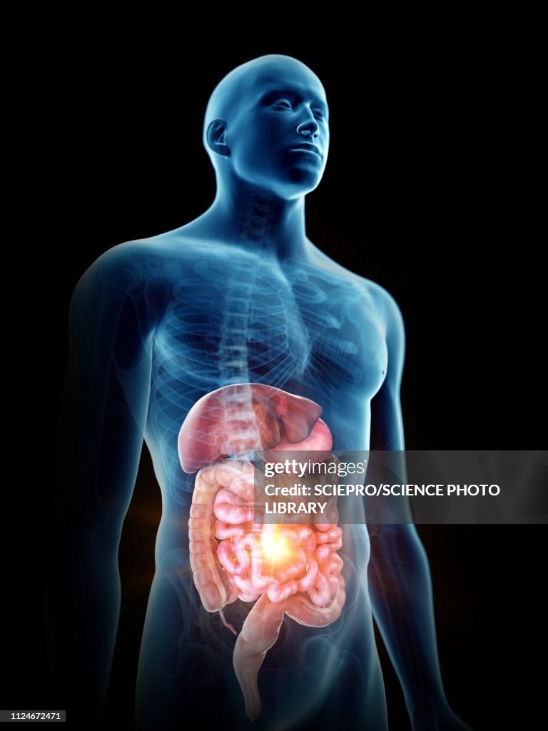 Illustration of a painful digestiverticale system