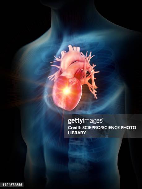 illustration of a painful heart - myocardium stock-grafiken, -clipart, -cartoons und -symbole