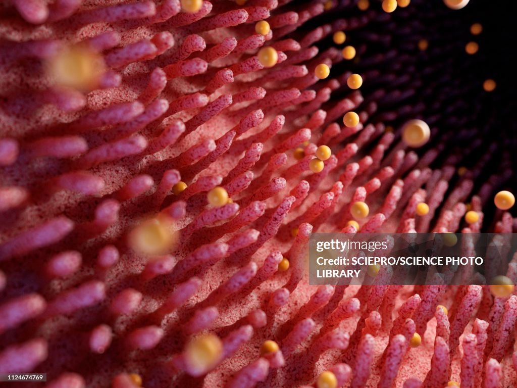 Illustration of gluten damaging intestinal verticalilli