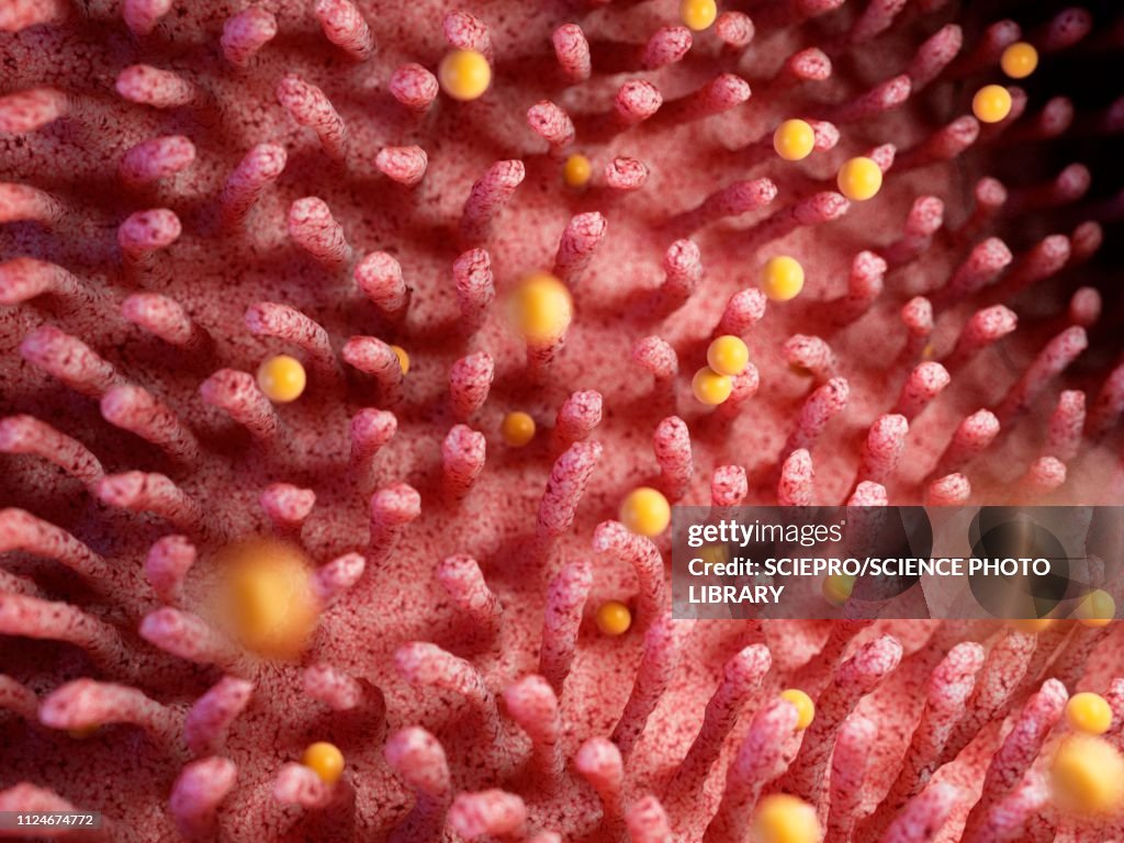 Illustration of gluten damaging intestinal verticalilli