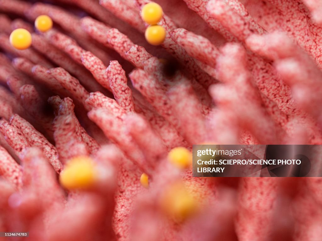 Illustration of gluten damaging intestinal verticalilli