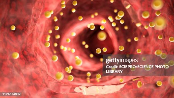 ilustrações de stock, clip art, desenhos animados e ícones de illustration of colon inflammation caused by gluten - bílis