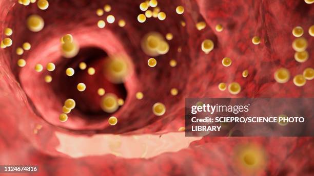 ilustrações de stock, clip art, desenhos animados e ícones de illustration of colon inflammation caused by gluten - lúmen