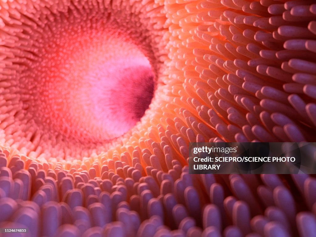 Illustration of intestinal verticalilli