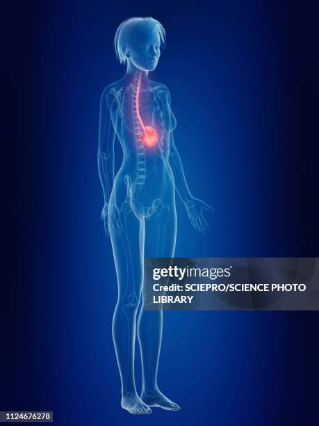 stockillustraties, clipart, cartoons en iconen met illustration of a woman's painful stomach - slokdarm