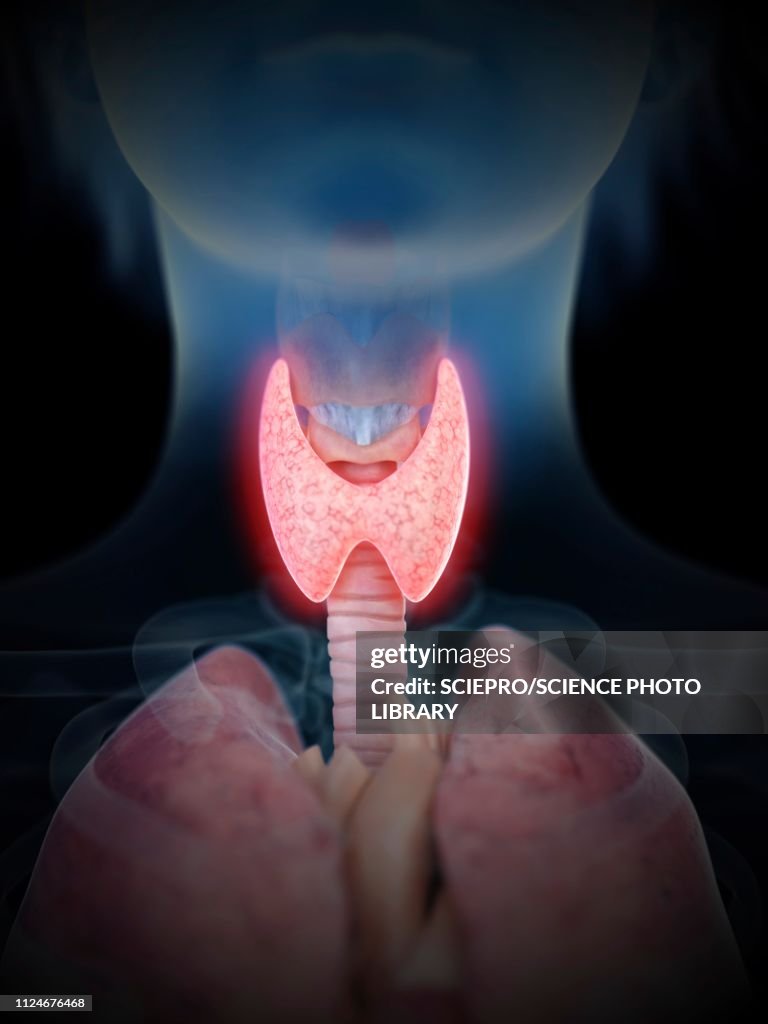 Illustration of an inflamed thyroid gland