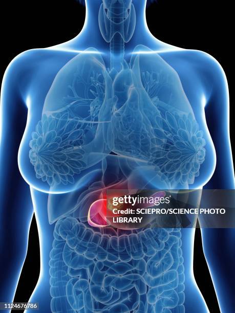 illustration of a woman's pancreas cancer - pancreatic cancer stock illustrations