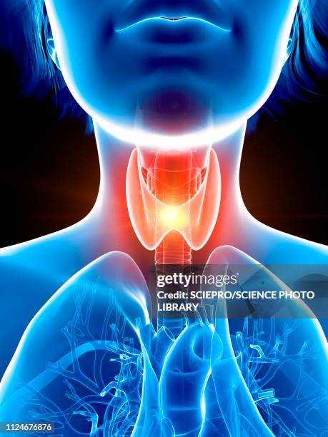 illustration of a woman's painful throat - thyroid stock illustrations