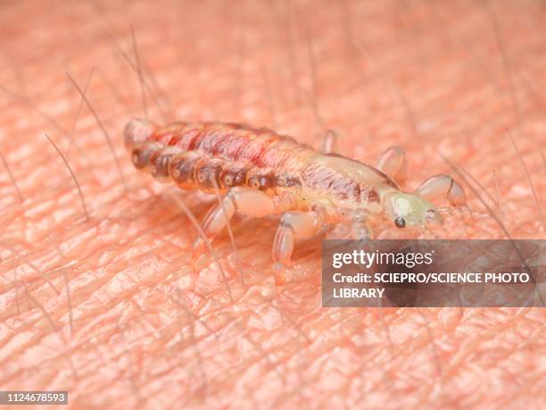 illustration of a head louse - louse stock illustrations