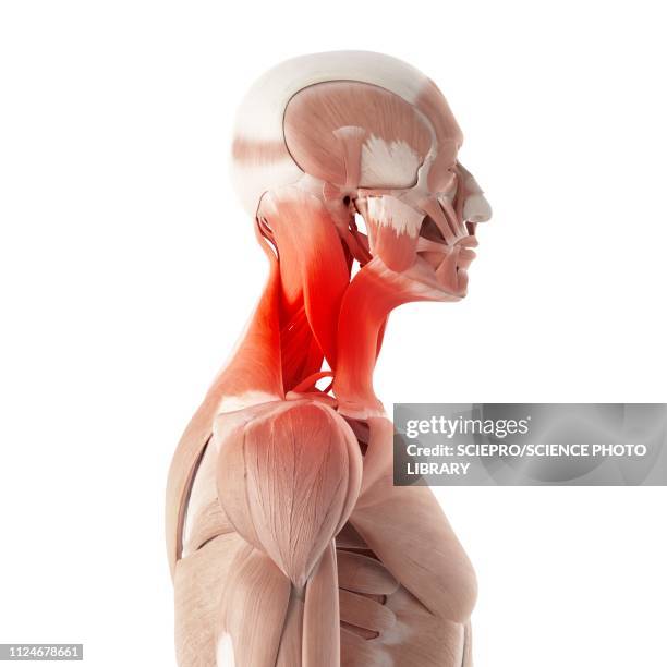 illustration of painful neck muscles - neck muscle pain illustration stock illustrations