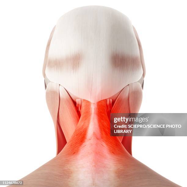 illustration of a painful neck - neck muscle pain illustration stock illustrations