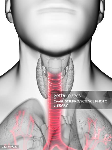 ilustrações, clipart, desenhos animados e ícones de illustration of a man's trachea - brônquio traqueia