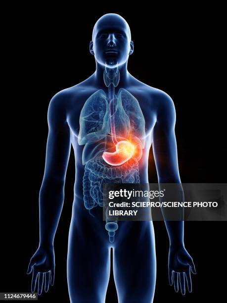 illustration of a man's stomach cancer - magen eines menschen stock-grafiken, -clipart, -cartoons und -symbole