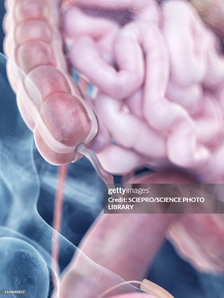 Labelled Appendix Graphic Illustration Of The Human Appendix Anatomy High-Res Vector Graphic ...