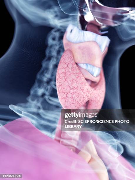 Normal Goiter Goiter Thyroid Photos and Premium High Res Pictures - Getty Images