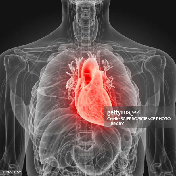 illustration of an inflamed heart - human heart stock-grafiken, -clipart, -cartoons und -symbole