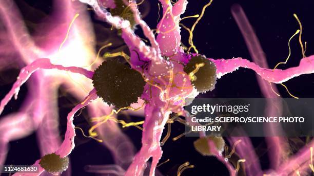 illustration of alzheimer's disease - neural axon点のイラスト素材／クリップアート素材／マンガ素材／アイコン素材