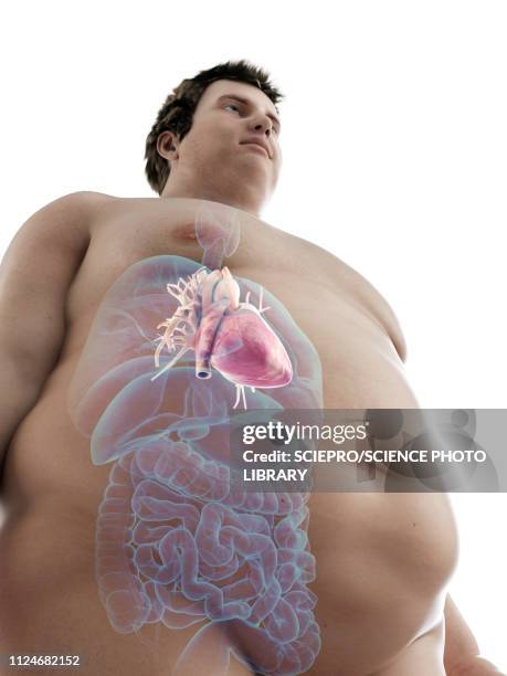 illustration of an obese man's heart - cardiologist stock illustrations