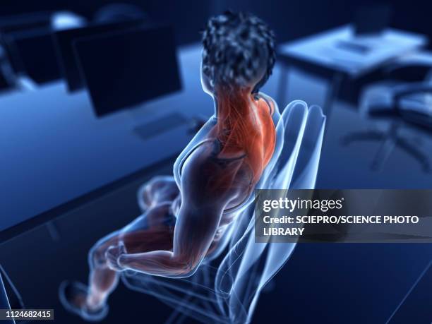 illustration of an office worker's painful muscles - neck muscle pain illustration stock illustrations