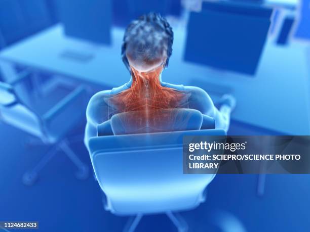 illustration of an office worker's painful muscles - neck muscle pain illustration stock illustrations