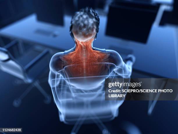 illustration of an office worker's painful muscles - neck muscle pain illustration stock illustrations