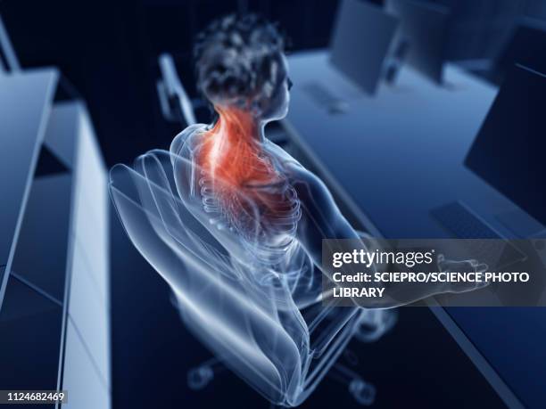 illustration of an office worker's painful muscles - neck muscle pain illustration stock illustrations