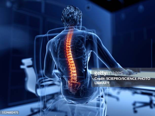 illustrazioni stock, clip art, cartoni animati e icone di tendenza di illustration of an office worker with a painful back - colonna vertebrale