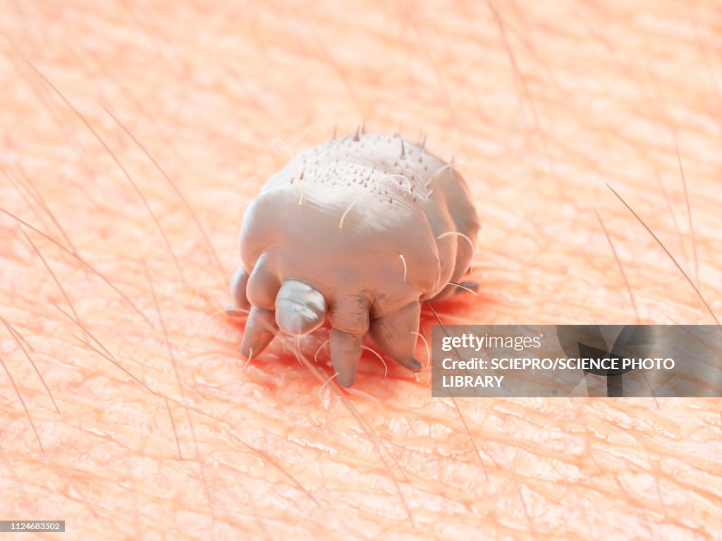 Illustration of a scabies mite