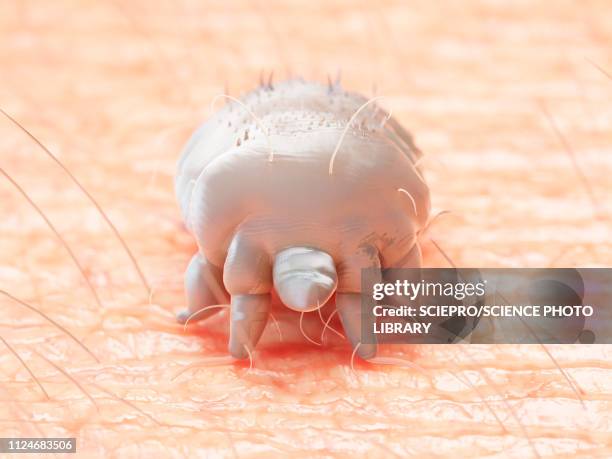 illustration of a scabies mite - skin problems stock illustrations