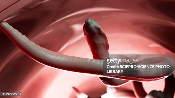 stockillustraties, clipart, cartoons en iconen met illustration of a roundworm in a human colon - nematode worm