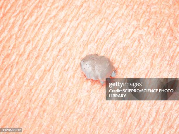 illustration of a scabies mite - scratching skin stock illustrations