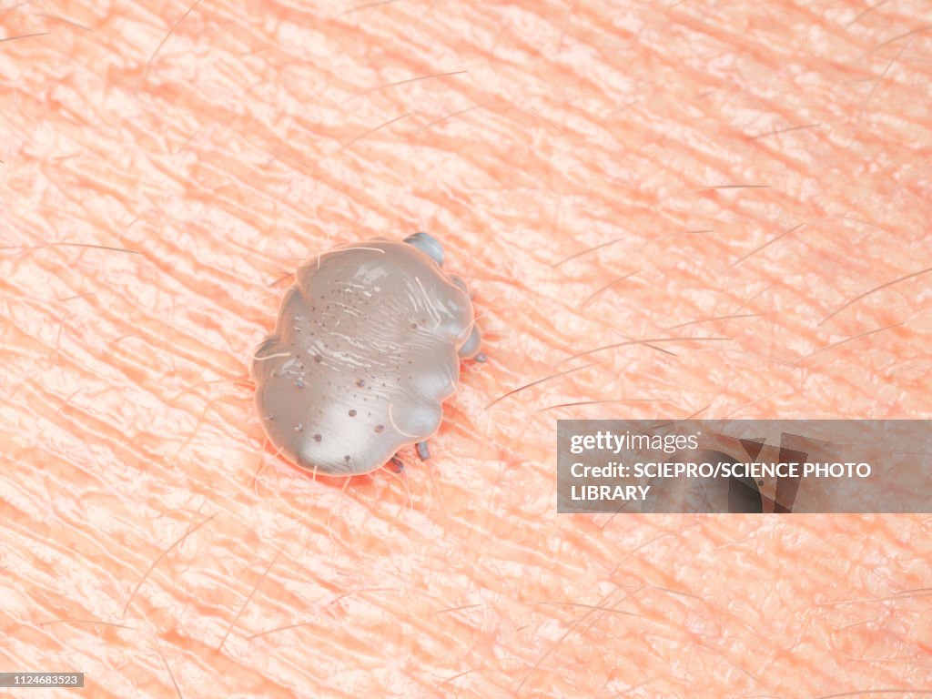 Illustration of a scabies mite on human skin