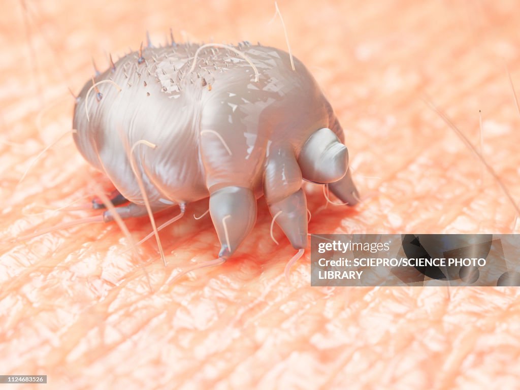 Illustration of a scabies mite on human skin